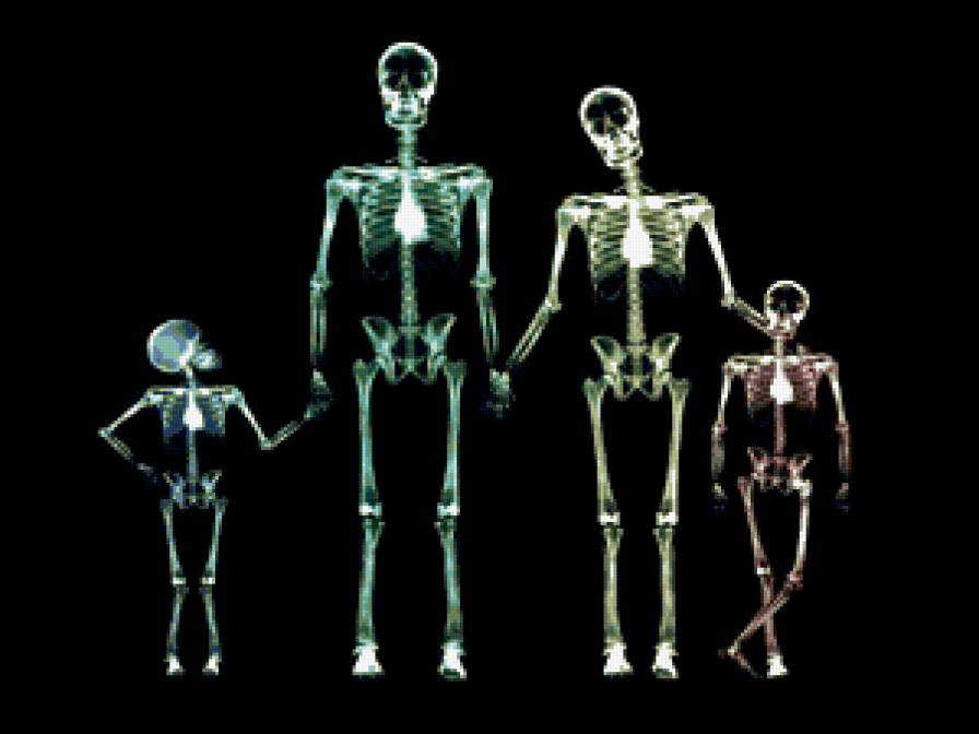 серия "внутрення красота" - кости, рентген, скелет - предпросмотр