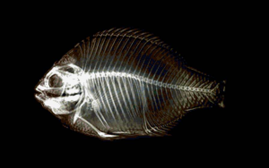 серия "внутрення красота" 7 - кости, рентген, скелет - предпросмотр