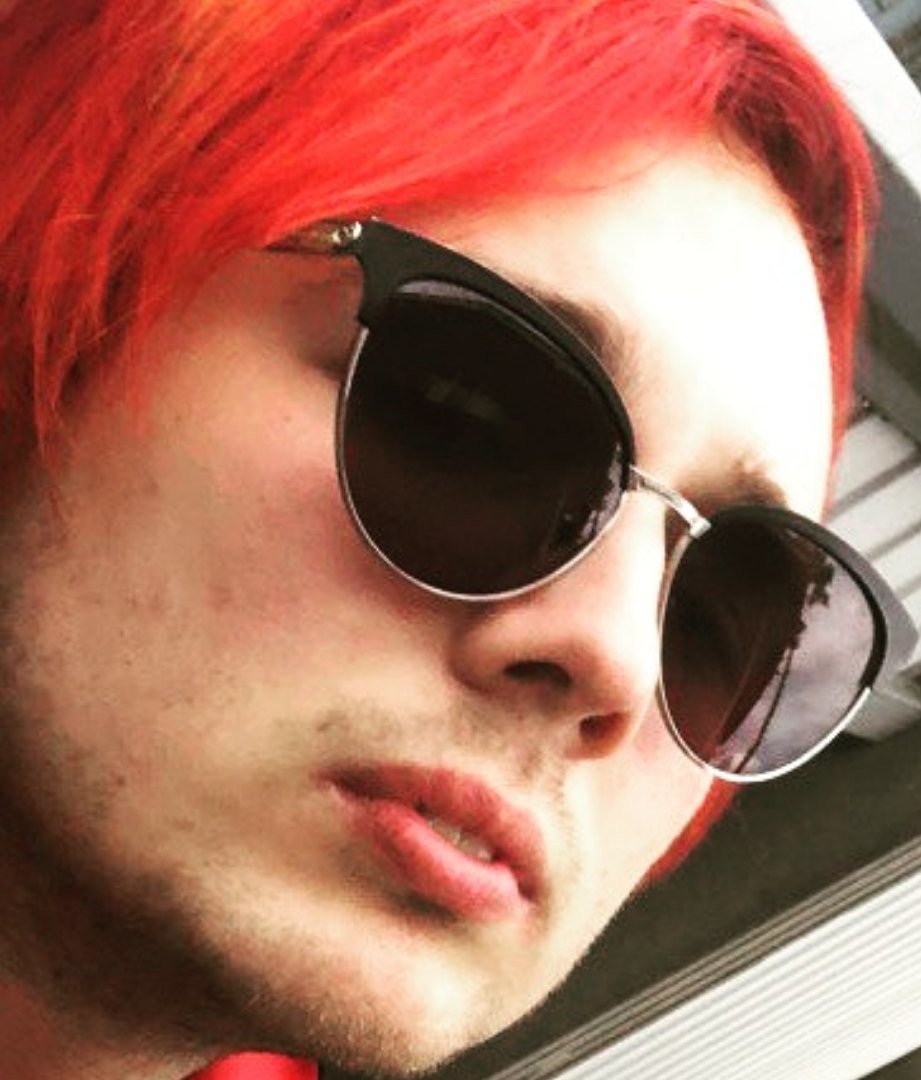 Даун на минималках - дцп, даун, аутизм - оригинал